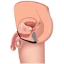 Стимулятор простати Prostatic Play Explorer II Prostate Stimulator And Cock Ring (чорний): Наявність вібрації  Есть